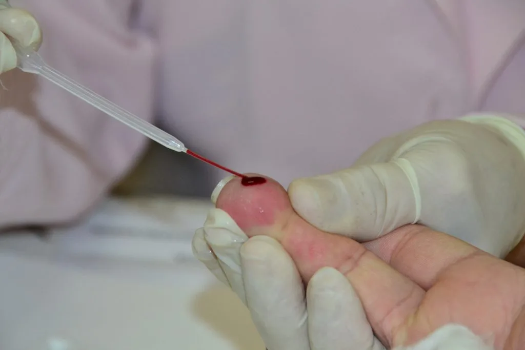 PMJP abre seleção de projetos voltados ao combate de ISTs, HIV e hepatites virais