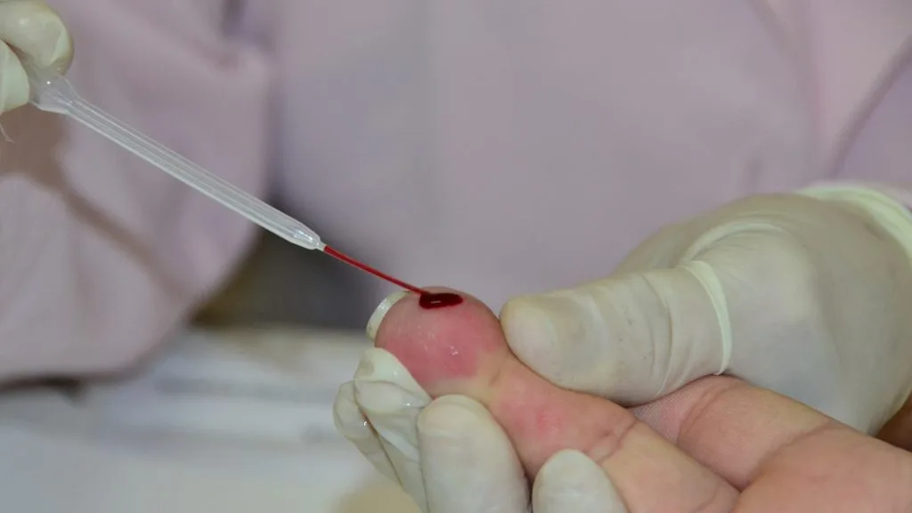 PMJP abre seleção de projetos voltados ao combate de ISTs, HIV e hepatites virais
